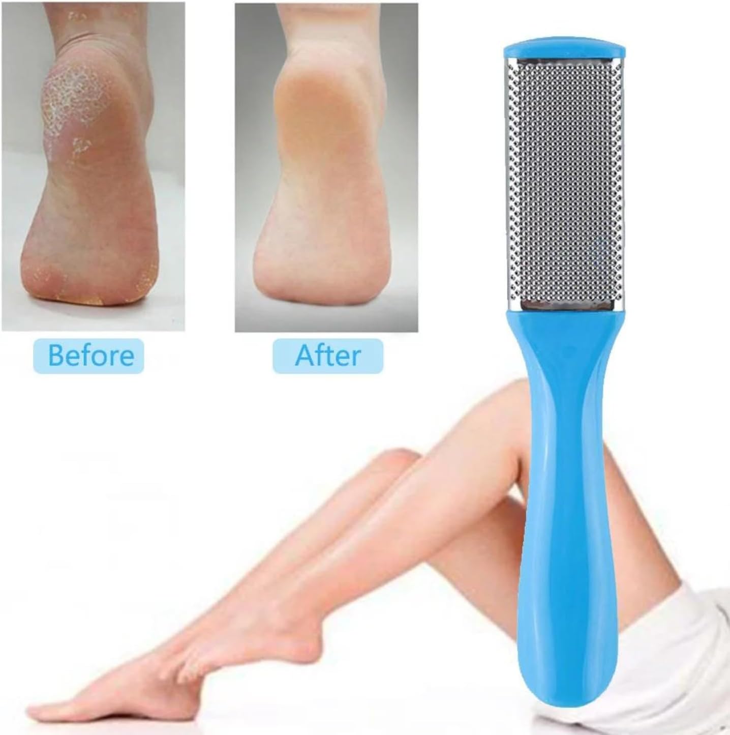 Max Life - Professional Stainless Steel Foot Callus Remover File Rasp Scraper Cracked Rough Pedicure Foot Care Tool